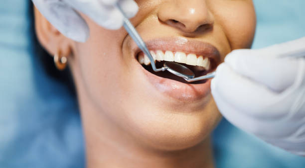 Professional  Dental Services in Cody, WY